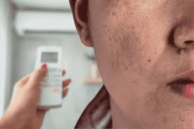 Dampak Udara Kering pada Kulit Sensitif